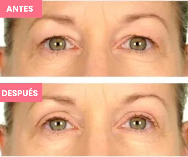 Rejuvenecedor UP - Palp Lifting Invisible