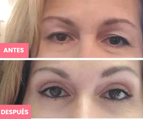 Rejuvenecedor UP - Palp Lifting Invisible