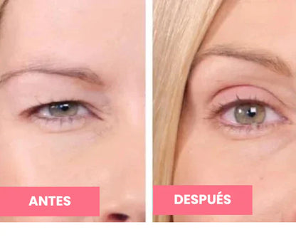 Rejuvenecedor UP - Palp Lifting Invisible
